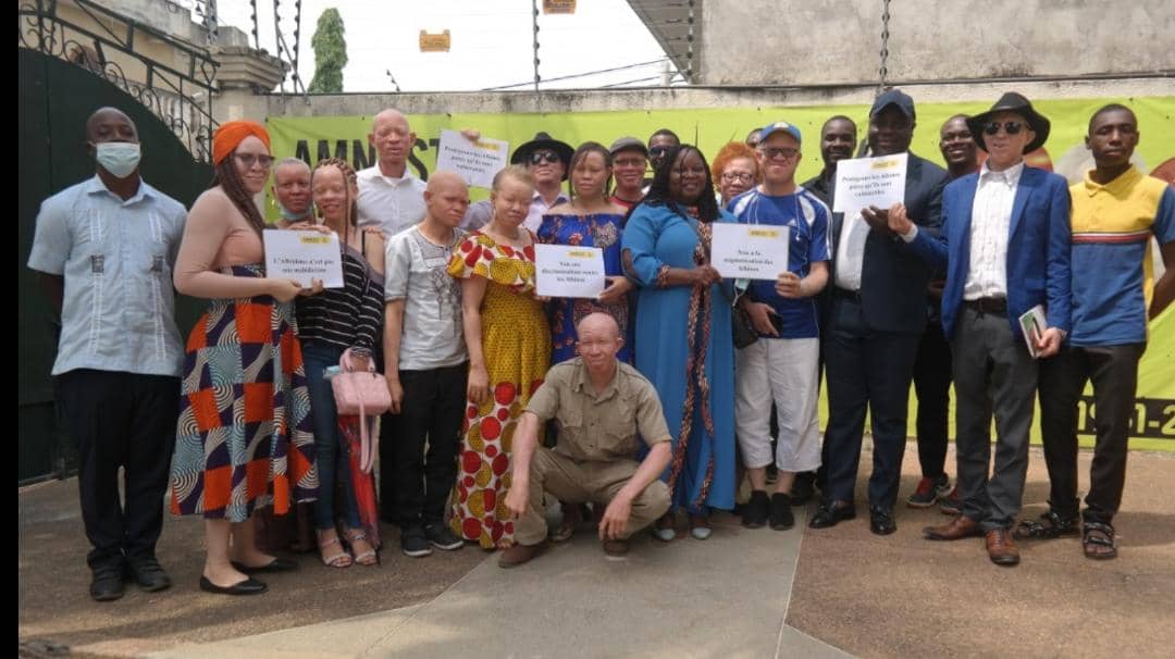 Albinisme / ‘’Qui a tué Titi le petit albinos ?’’ met à nu la situation des albinos en Côte d'Ivoire