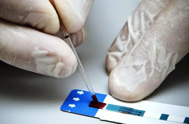Riposte au VIH / Le dépistage différencié, une solution pour plus d’efficacité